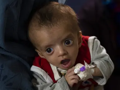Seorang ibu menggendong bayinya saat menjalani perawatan di bangsal gizi buruk RS Anak Nasional Ataturk, Kabul, Afghanistan, 2 Desember 2021. Menurut PBB dari awal November, hampir 24 juta orang di Afghanistan, sekitar 60 persen dari populasi, menderita kelaparan akut. (AP Photo/Petros Giannakouris)