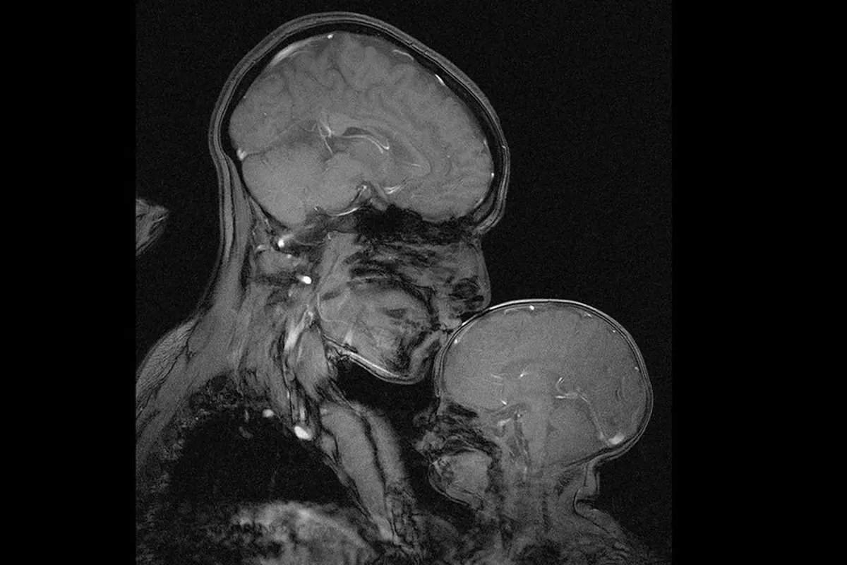 Hasil MRI Ini Tujukkan Kekuatan Otak Ibu Dan Anak