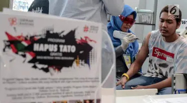 Petugas Komunitas Gerak Bareng melakukan proses penghapusan tato dalam acara Hijrah Fest 2018 di Jakarta, Sabtu (10/11). Program ini dilakukan secara gratis. (Liputan6.com/Faizal Fanani)