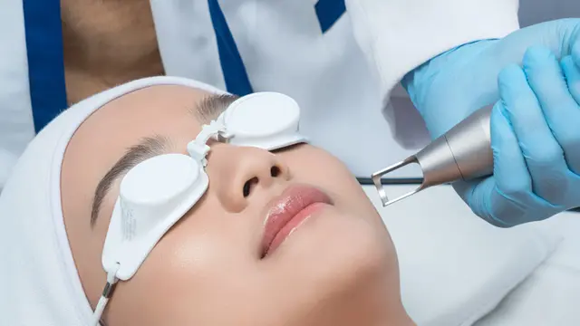 Beauty Review: Mengatasi Hiperpigmentasi Tanpa Iritasi dengan Perawatan Laser yang Harganya Terjangkau