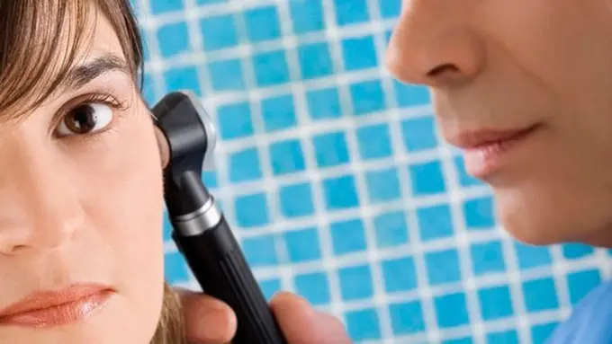 [Bintang] Selama Sembilan Hari Kecoak Tinggal di Telinga Perempuan Ini, Ceritanya Horor Banget