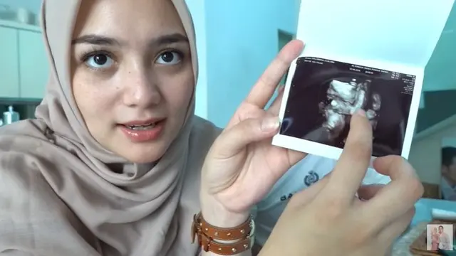 Citra Kirana