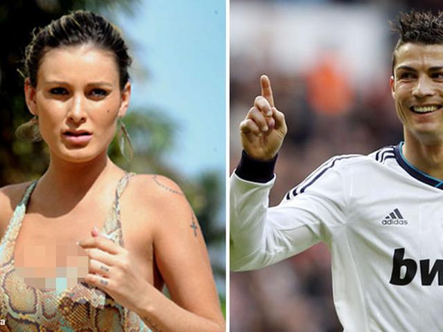 Kronologi Operasi Plastik Berujung Apes Selingkuhan Ronaldo Bola Liputan6 Com