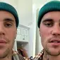 5 Fakta Justin Bieber Alami Kelumpuhan Wajah, Batalkan Beberapa Konser (IG/justinbieber)