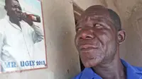 Menangi Kontes Pria Terjelek di Zimbabwe, Pria Ini Malah Bangga