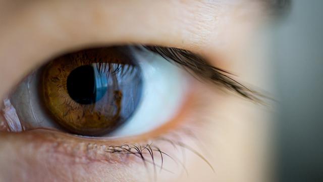 Eye