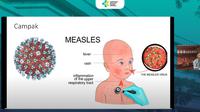 Virus campak seperti dipaparkan Prof Hartono (Tangkapan Layar Youtube Kemenkes)
