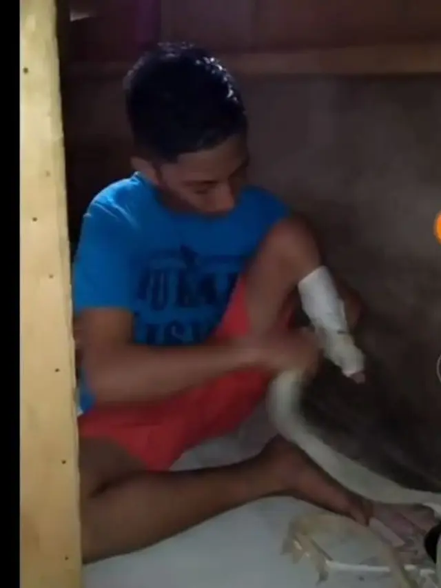 [Bintang] Tulis Surat untuk Presiden Jokowi, Anak Ini Minta Dibelikan Kaki Palsu