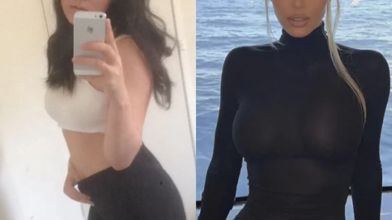 Cerita Perempuan Korea Lakukan 15 Operasi Plastik Agar Mirip Kim Kardashian