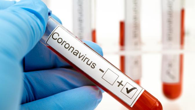 ilustrasi virus corona covid-19/photo copyright by Shutterstock