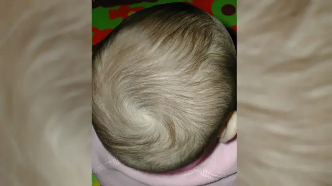 Beberapa bayi dilahirkan sudah berambut di kepalanya. (Sumber Wikimedia Commons)