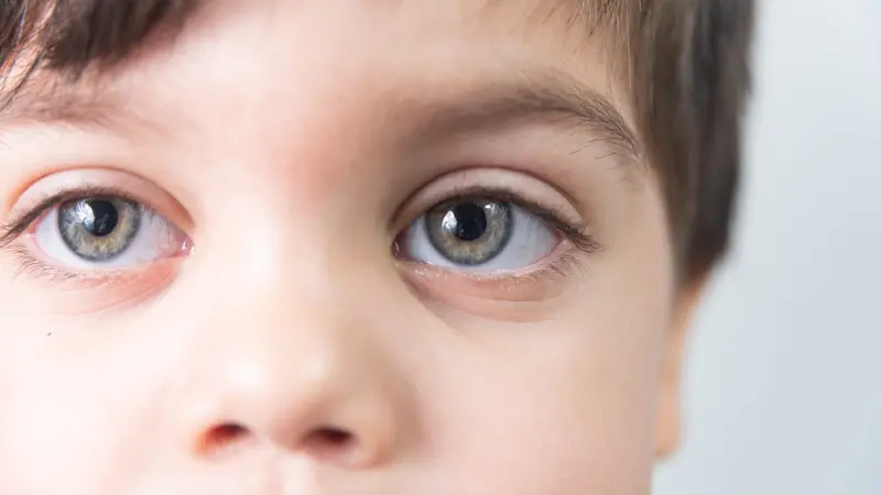 7 Langkah Mudah Jaga Kesehatan Mata Anak Sejak Dini agar Terhindar dari Gangguan Penglihatan