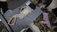 Organisasi Kesehatan Dunia (WHO) mengatakan pada hari Selasa bahwa malnutrisi di Gaza utara “sangat ekstrem.” (AP Photo/ Jehad Alshrafi)