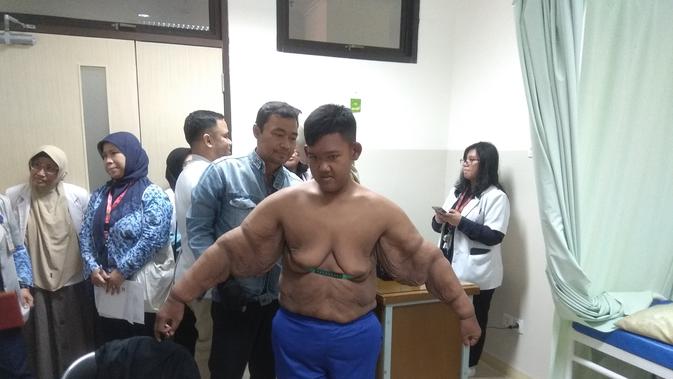 Pasien eks obesitas asal Karawang Jawa Barat Arya Permana, tengah dilakukan pengukuran baju di ruang poliklinik anak RSHS, untuk dipakai usai operasi bedah plastik pada 24 Juli 2019 mendatang. (Liputan6.com/Arie Nugraha)
