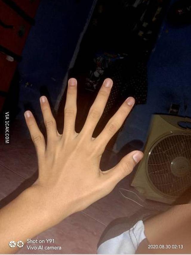 6 Editan Foto Bagian Tangan Ini Absurd Banget, Enggak Habis Pikir