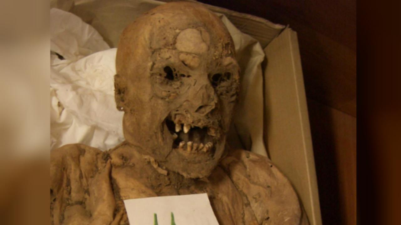 Mumi asal Hungaria yang membantu para ilmuwan untuk memahami penyebab kanker kolorektal (Foto: Tel Aviv University).