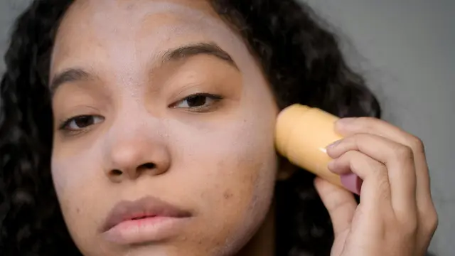Jerawat Sering Kambuh? Berikut Cara Memperbaiki Skin Barrier Agar Jerawat Tidak Mudah Muncul