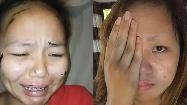 [Bintang] Salah Pakai Masker, Cewek Ini Nangis Kejer karena Kesakitan dan Alisnya Hilang
