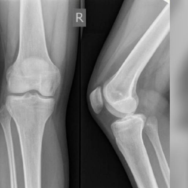 Kisah Mengerikan Di Balik 4 Hasil Foto Rontgen Bikin Ngilu Citizen6 Liputan6 