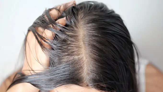 Rambut Gampang Lepek? Ini Tips agar Rambut-Mu Tidak Gampang Lepek