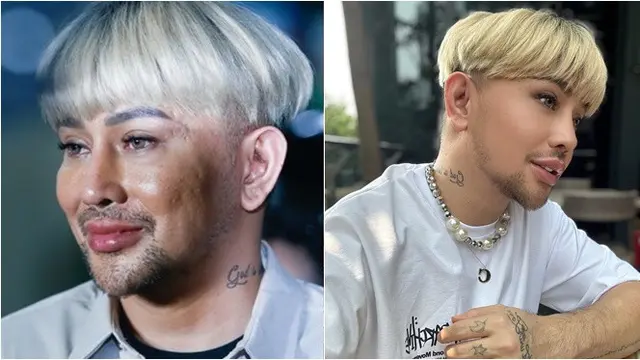 Potret Wajah 6 Artis Ini Jadi 'Korban' Kamera Wartawan, Perbedaannya Disorot