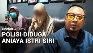 Tega! Polisi di Tegal Diduga Siram Istri Siri dengan Air Keras