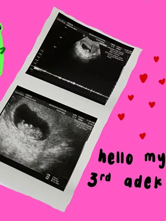 Nola B3 (Instagram/naura.ayu)