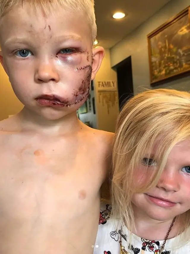 Kisah Peristiwa Penyelamatan Sang Adik