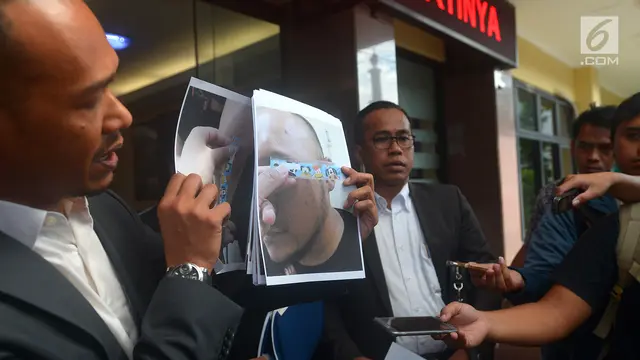Polisikan Herman Hery, Pelapor Tunjukkan Sejumlah Gambar