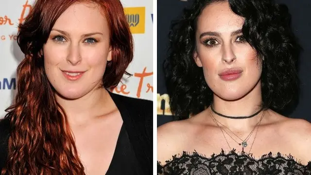 artis sebelum vs setelah operasi plastik
