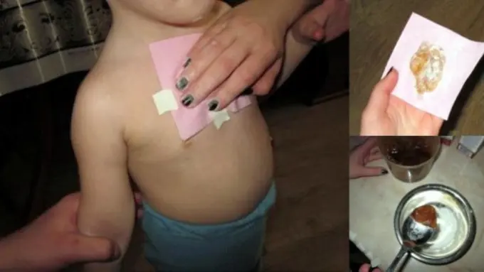 Cara Ciamik Bikin Batuk Anak Lenyap dalam Semalam Saja!