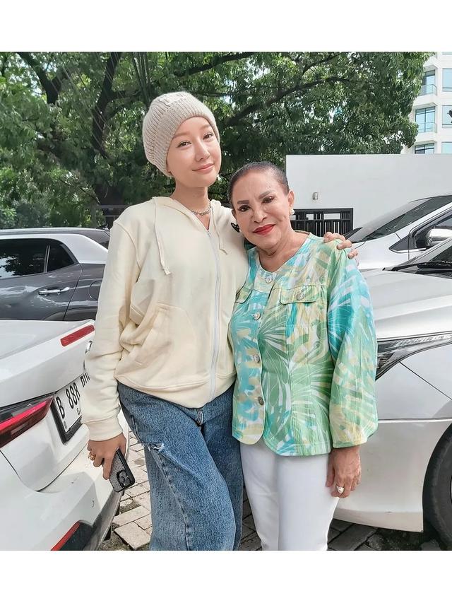 6 Potret Mpok Atiek yang Idap Polip di Ususnya, Akui Takut Ramalan Roy Kiyoshi