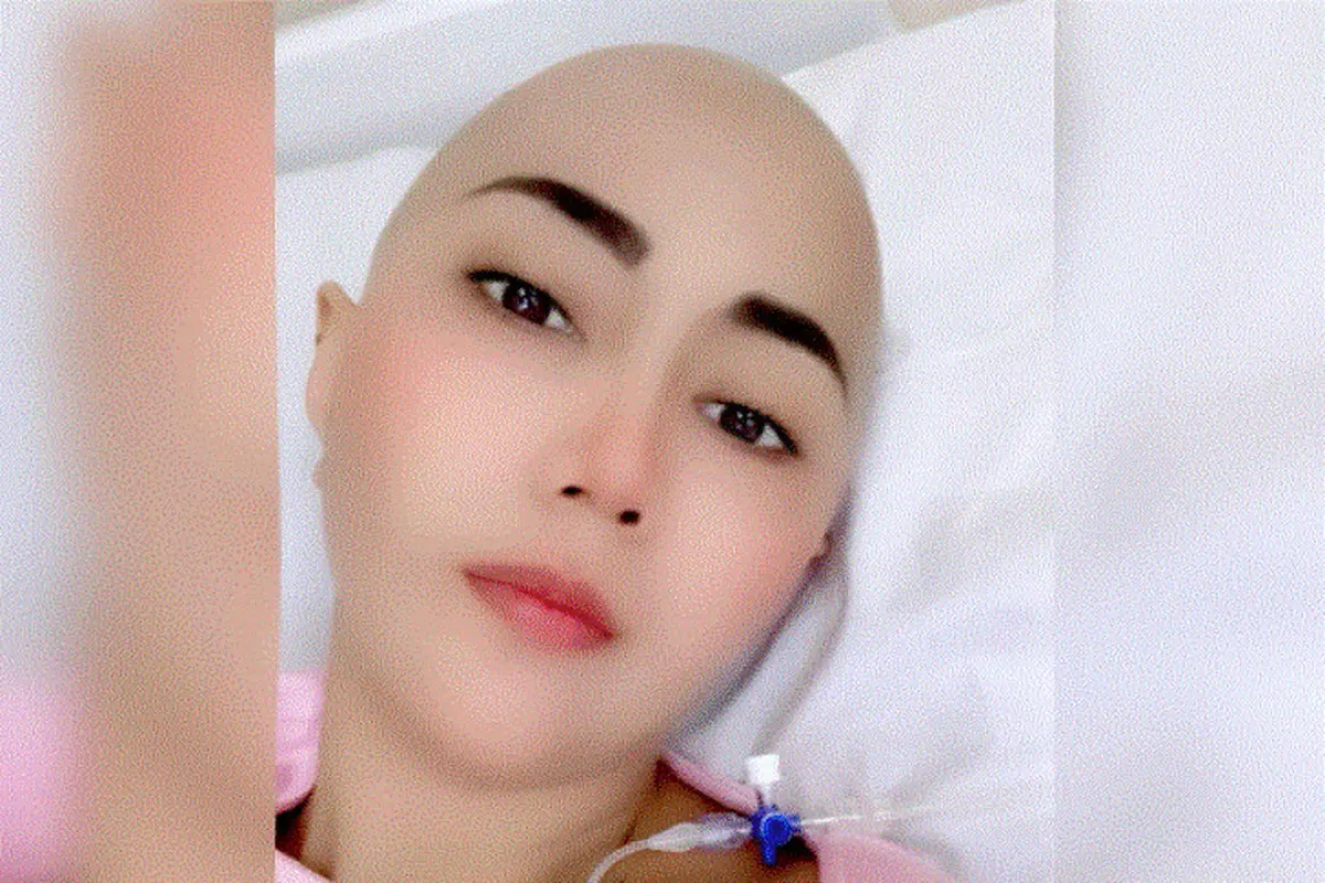 Aida Sakia jalani kemoterapi akibat kanker payudara