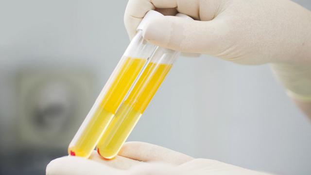 Uae Kembangkan Terapi Sel Punca Untuk Bantu Pengobatan Covid 19 Health Liputan6 Com