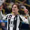 Kenan Yildiz Absen Bela Juventus Tiga Bulan