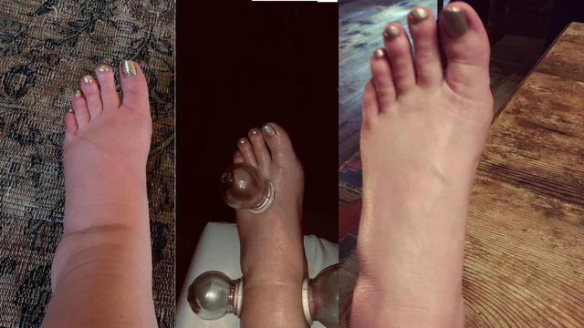 Kaki Jessica Simpson sebelum dan setelah dibekam (Instagram/ jessicasimpson)