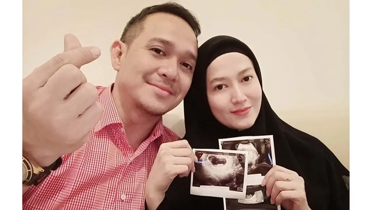 Hamil Setelah 7 Tahun Nikah, Ini 6 Potret Lyra Virna Pamer Perut Buncit
