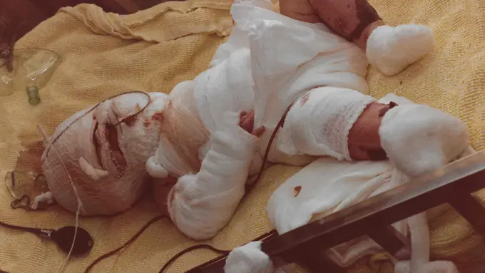 Hampir Meninggal, Lelaki Ini Berbagi Kisah yang Memukau Publik