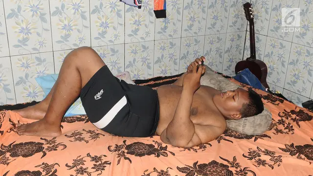 Penampakan Arya Permana Si Bocah Obesitas yang Turun 105 Kilogram