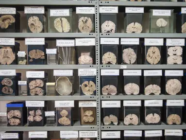Koleksi otak manusia yang diawetkan di Museum Neuropatologi, di Rumah Sakit Santo Toribio de Mogrovejo, Lima, Peru (16/11). RS ini menyimpan sekitar 290 otak manusia yang dapat dilihat langsung sebagai bahan pembelajaran. (AFP Photo/Ernesto Benavides)