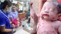 Kena 14 Luka Tusukan dan Dikubur, Bayi Ajaib Ini Masih Hidup