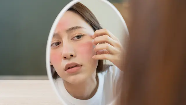 5 Manfaat Salicylic Acid Untuk Kecantikan-Mu
