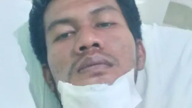 Salah satu korban petani korban penembakan di Desa Sontang, Kabupaten Rokan Hulu.