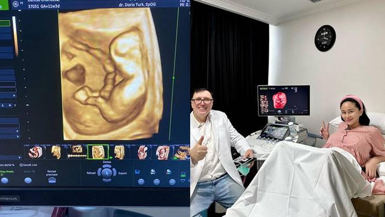 7 Potret Denise Chariesta Saat Periksa Kehamilan, Banjir Kritikan Netizen