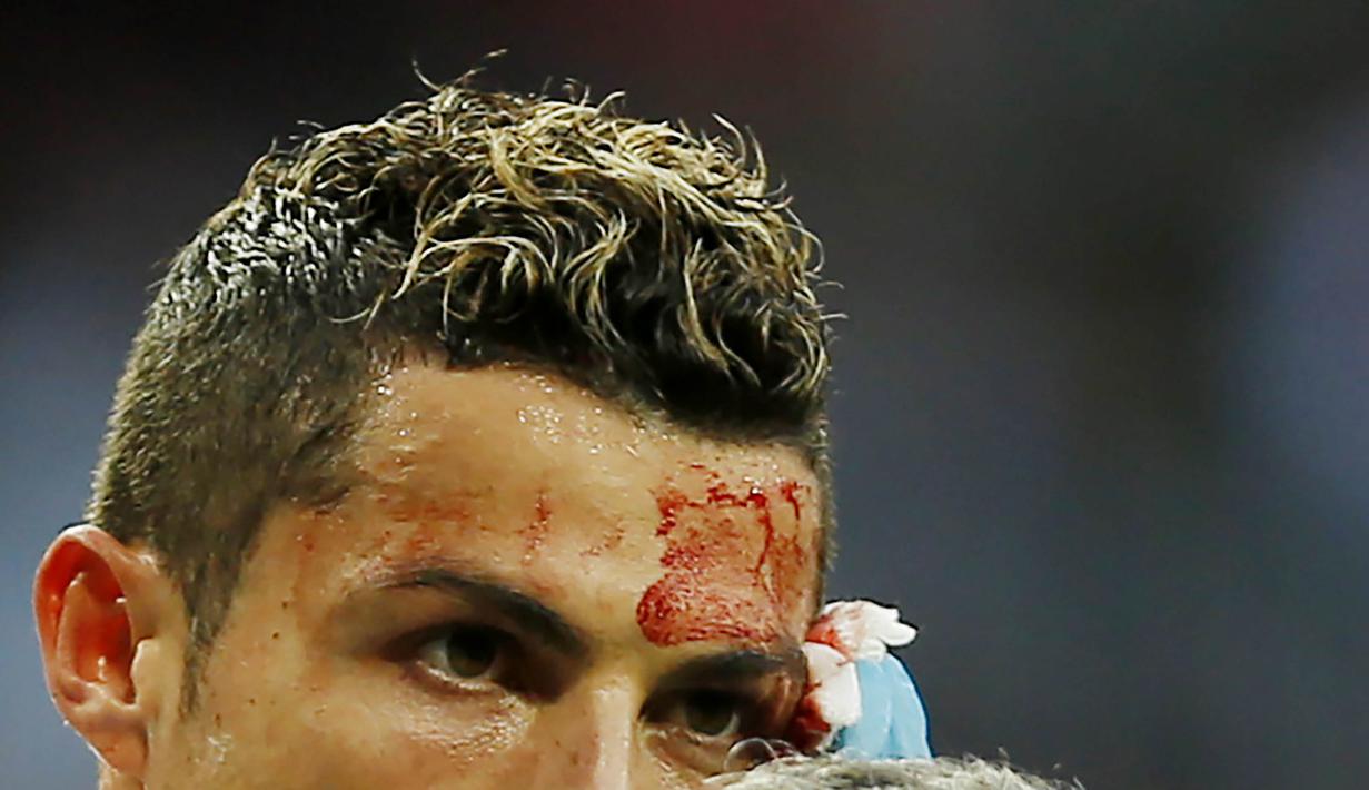 Striker Real Madrid, Cristiano Ronaldo, mengalami pendarahan di bagian pelipis saat melawan Deportivo La Coruna pada laga La Liga di Stadion Santiago Bernabeu, Minggu (21/1/2018). Real Madrid menang 7-1 atas Deportivo La Coruna. (AP/Francisco Seco)