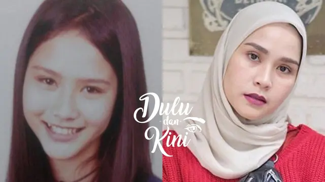 Dulu Dan Kini Transformasi Zaskia Adya Mecca Dari Cupu Hingga Menawan Beauty Fimela Com