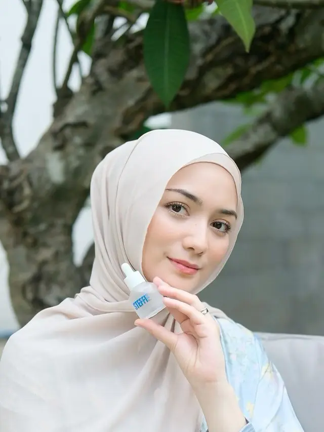 Citra Kirana. (Foto: Dok. Istimewa)
