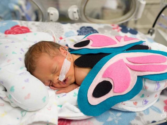Syarat Agar Bayi Prematur Dapat Tumbuh Sehat Health Liputan6 Com
