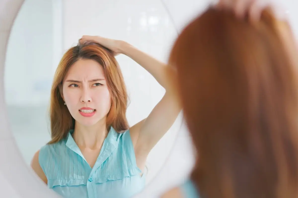 Bukan Hanya Stress Saja, Ini Gaya Hidup Nggak Baik Lainnya yang Bisa Sebabkan Permasalahan Ketombe Pada Kulit Kepala