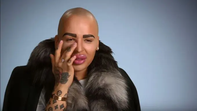 OMG! Cowok Ini Ingin Banget Bibirnya Seksi Kayak Kim Kardashian